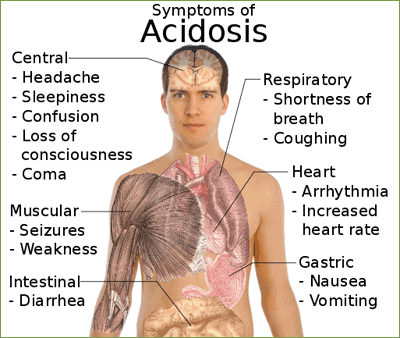 Symptoms Acidosis